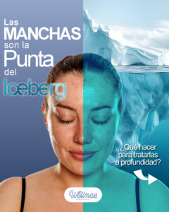 Carrusel - Manchas - 01