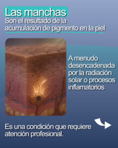 Carrusel - Manchas - 02
