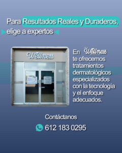 Carrusel - Manchas - 04